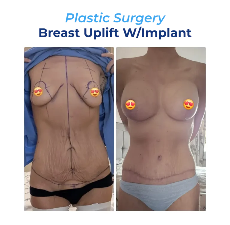 Before After-13