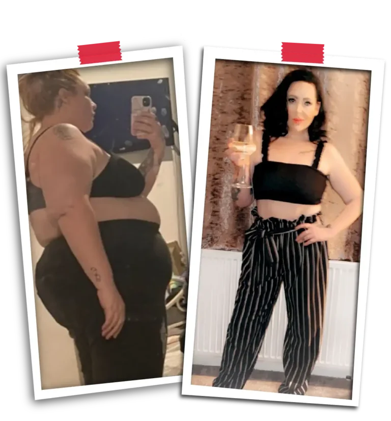 Gastric Sleeve Before & After Results | Visit Plus Care