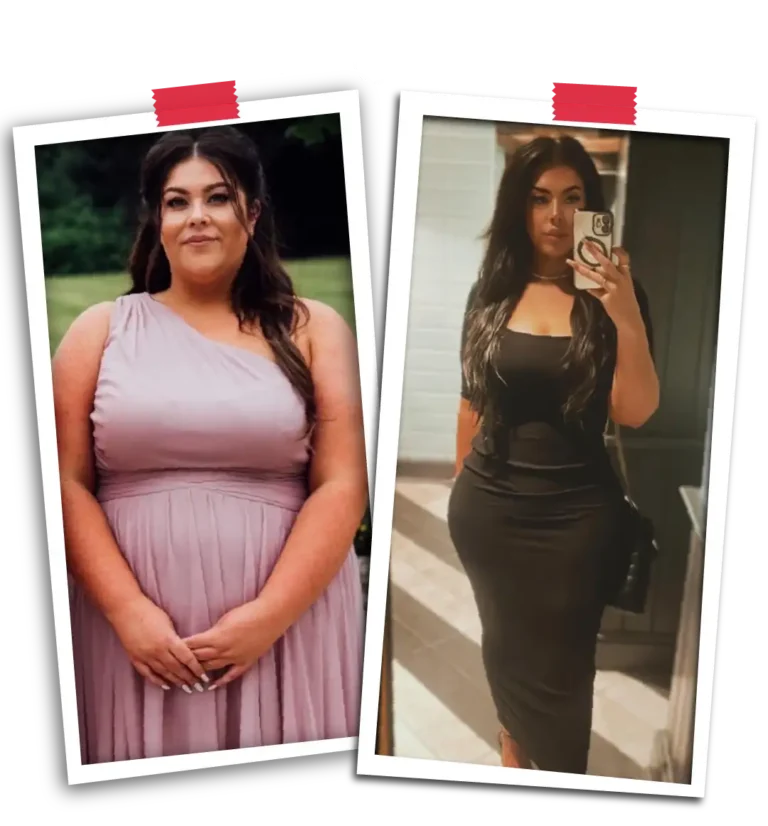Bariatric Surgery Excellence in Turkey