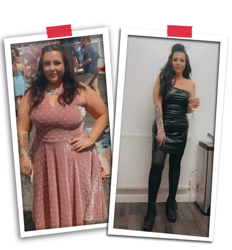 Bariatric Before After VP-04