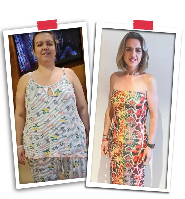 Bariatric Before After VP-05