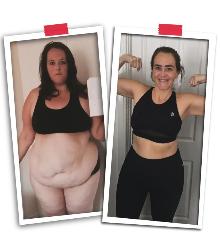 Weight Loss Surgery with Visit Plus Care