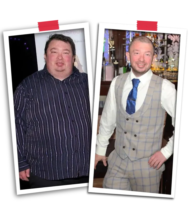 Trusted Weight Loss Surgery for International Patients