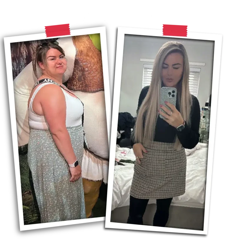 Trusted Weight Loss Surgery for International Patients