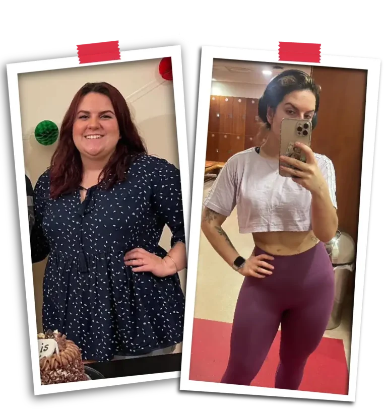 Your Weight Loss Surgery Journey with Visit Plus Care