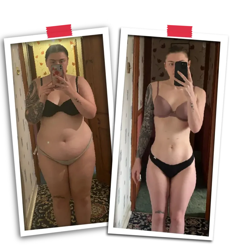 Bariatric Before After VP-14