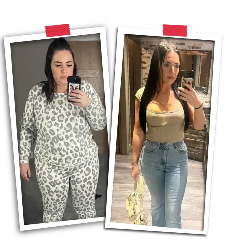 Sustainable Weight Loss with Gastric Bypass | Visit Plus Care