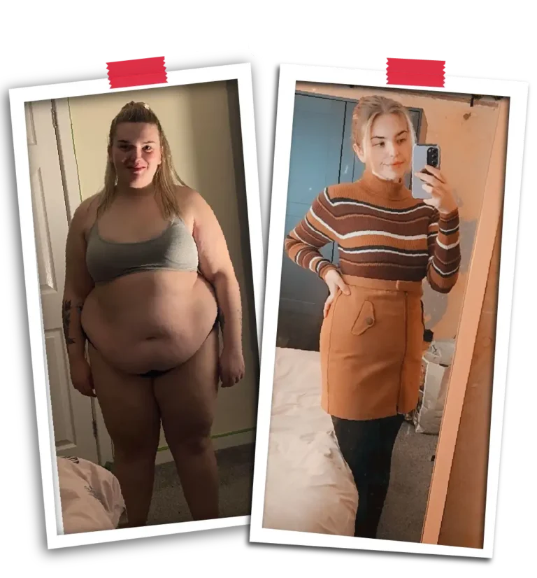 Your Gastric Sleeve Experience with Visit Plus Care