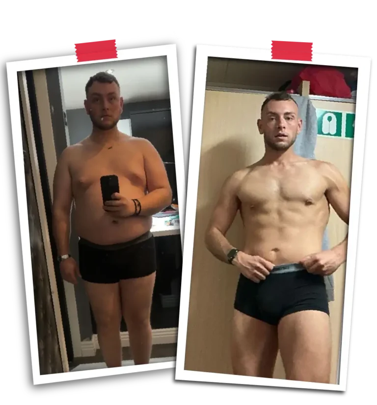 Bariatric Before After VP-18