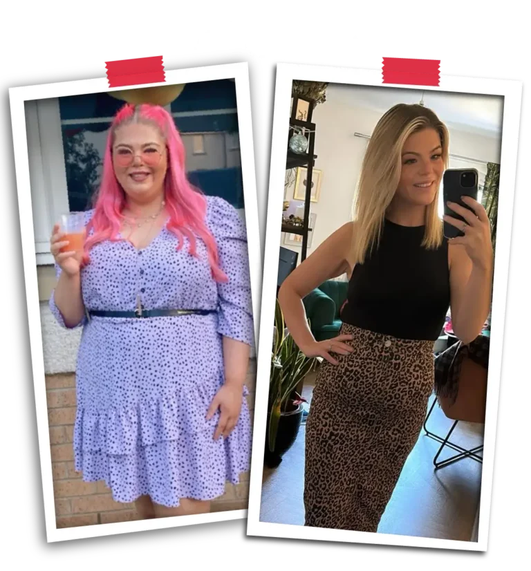 Gastric Sleeve Surgery with Visit Plus Care