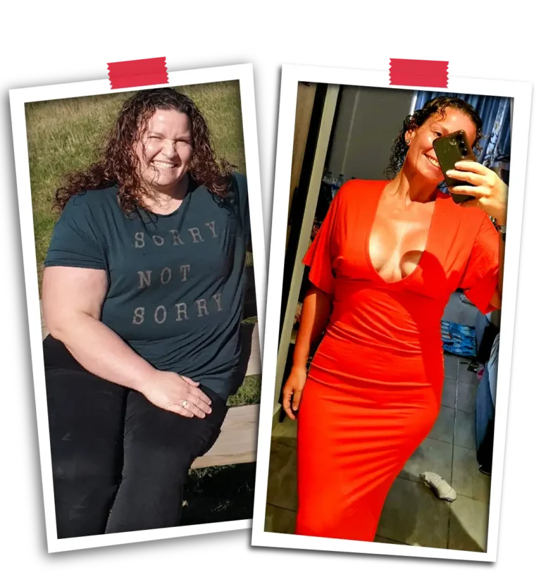 Gastric Bypass Surgery Before & After