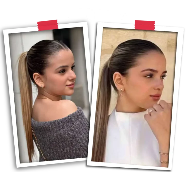 Rinoplasti Before After-13
