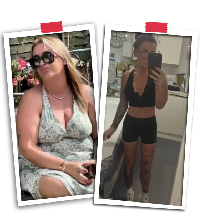 Bariatric Before After 2026-21