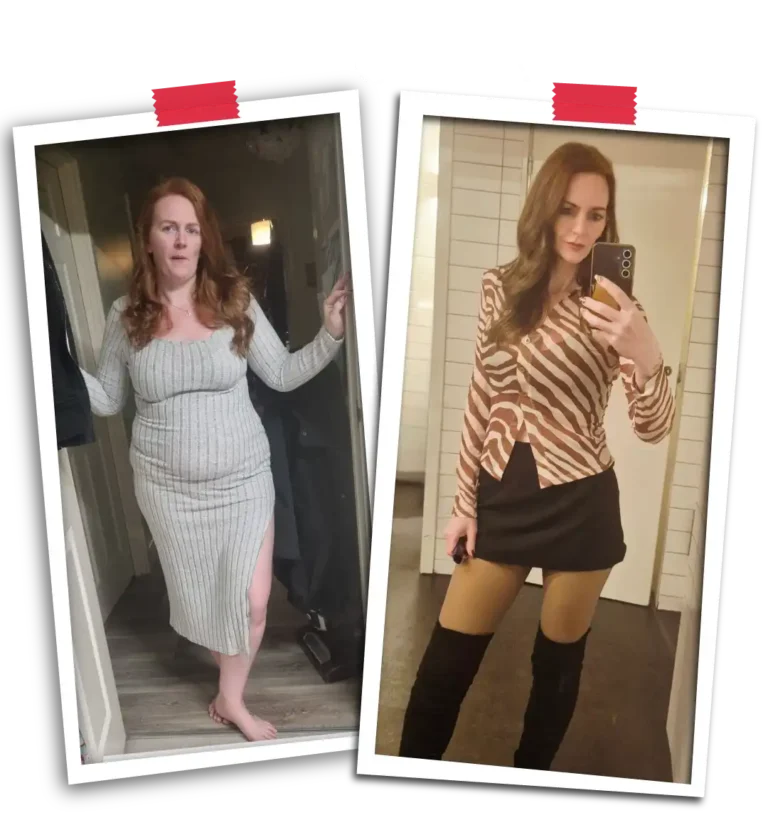 Bariatric Before After 2026-22