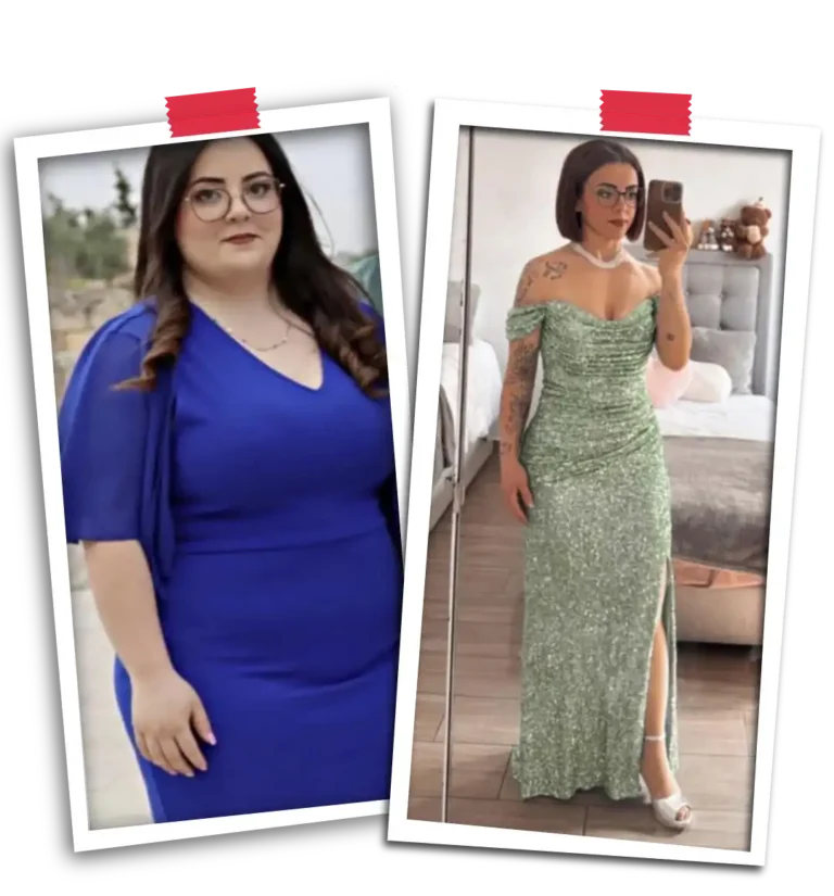 Bariatric Before After 2026-23