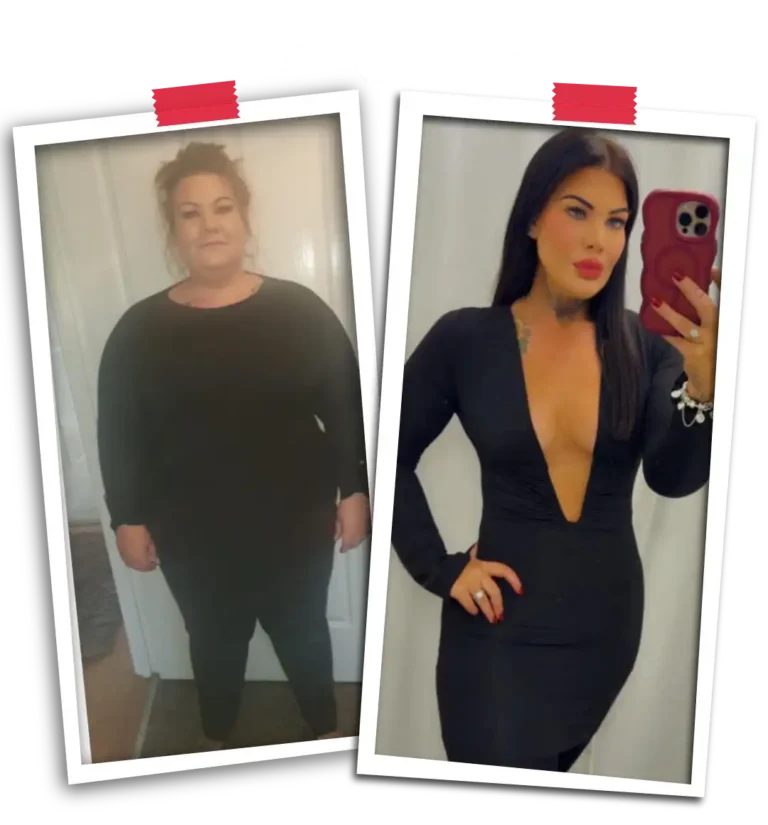 Bariatric Before After 2026-24
