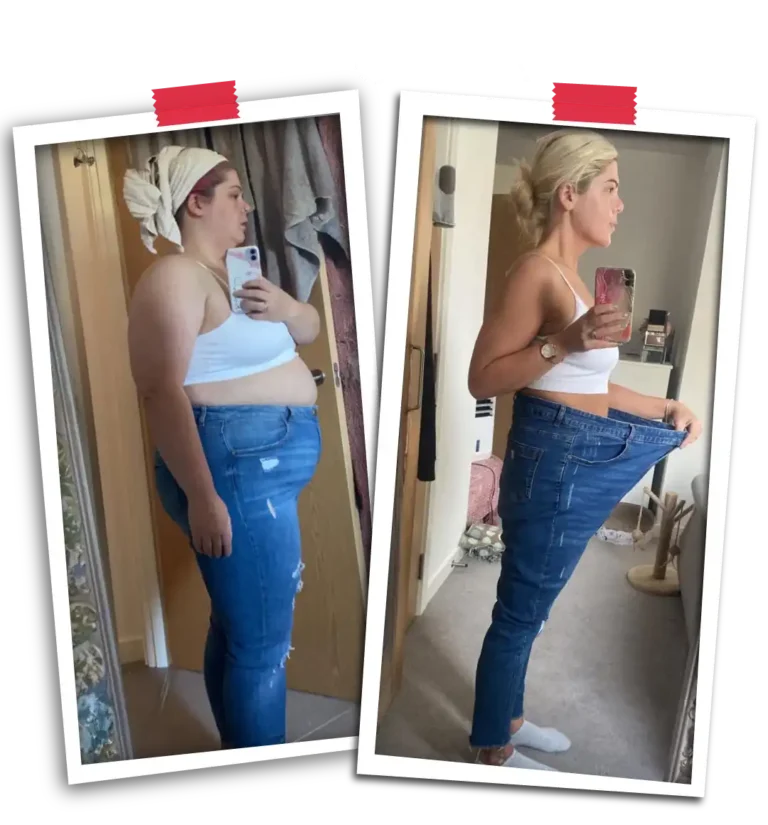 Bariatric Before After 2026-25