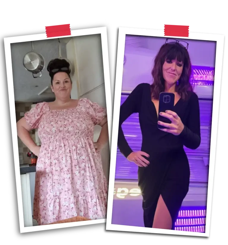 Bariatric Before After 2026-26
