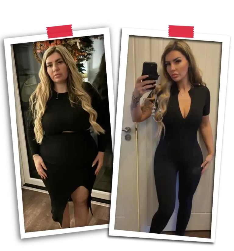 Bariatric Before After 2026-28