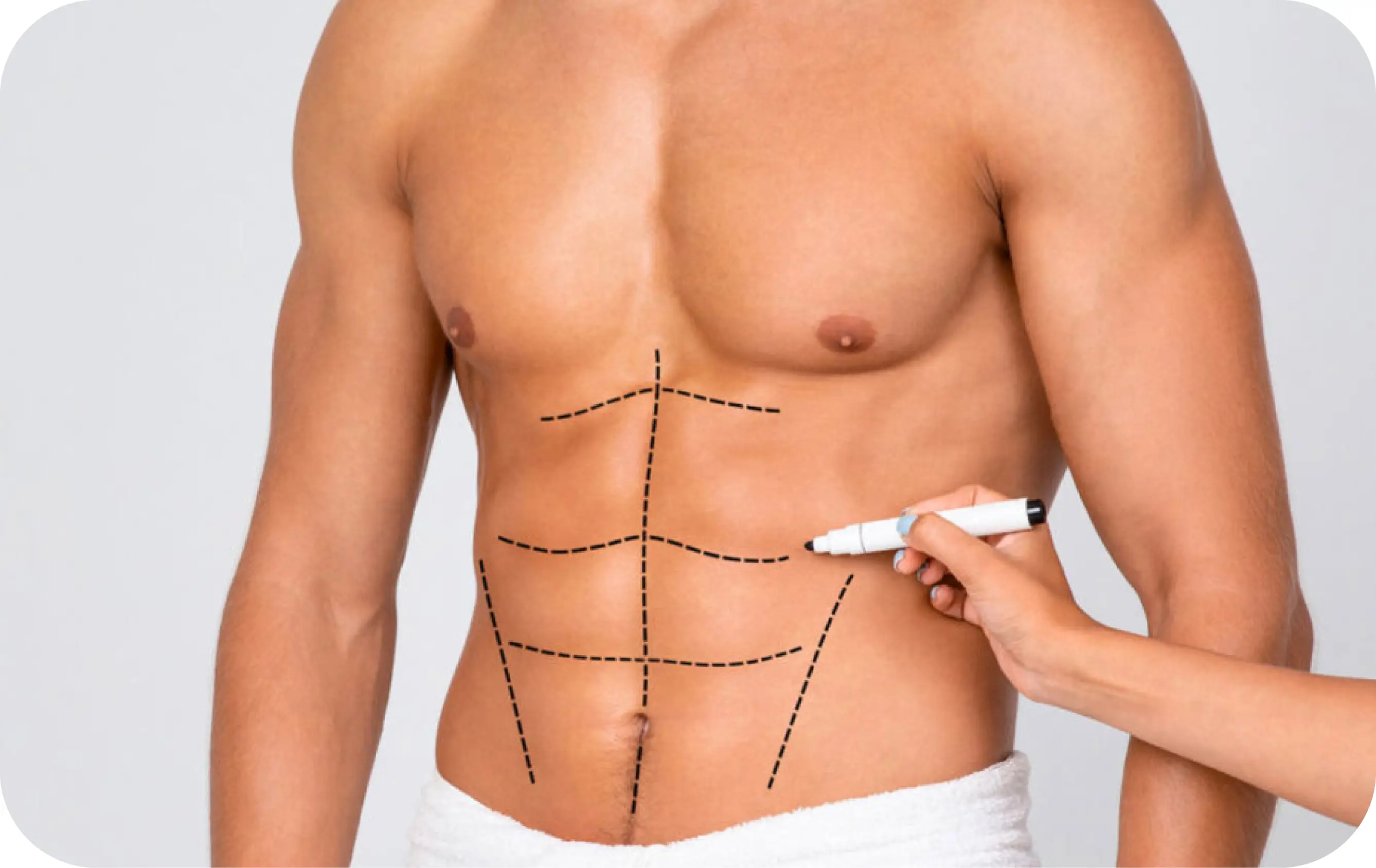Abdominal Etching