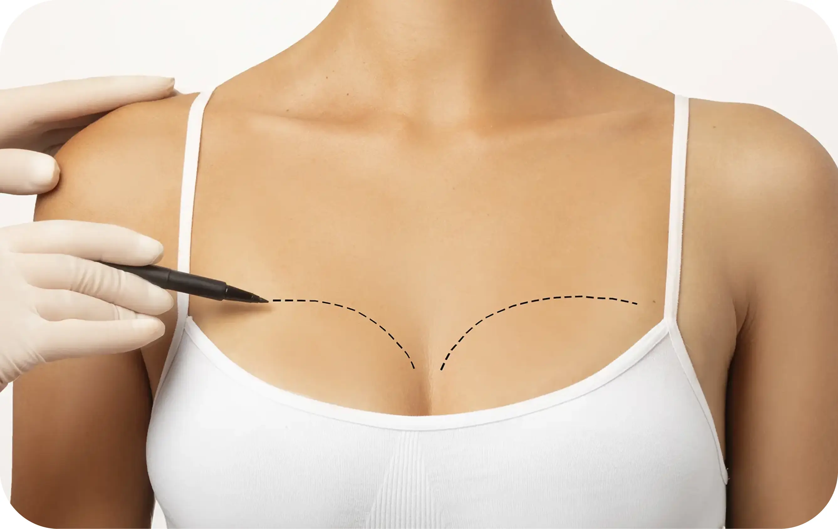 Breast Aesthetics