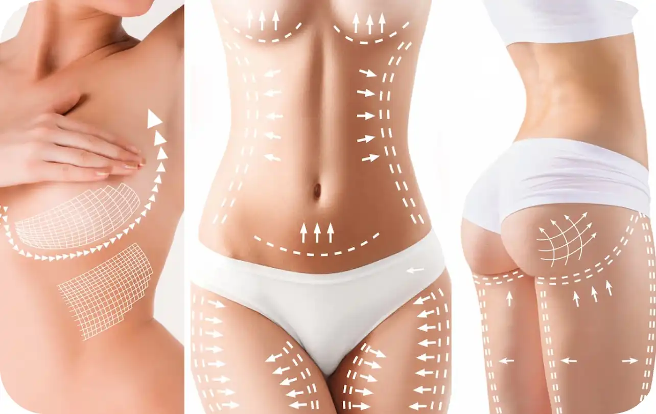 Plastic Surgery